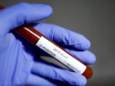 Di Gowa, 106 Pasien Positif Covid-19 Dinyatakan Sembuh