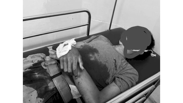 Tragedi Subuh Berdarah di Mamajang: Remaja 15 Tahun Tewas Ditikam, Pelaku Kini Buron!